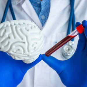 Laboratory medical diagnostics, tests for brain and neurological system concept photo. Doctor or laboratory technician holds in one hand laboratory test tube with blood, in other - figure of brain